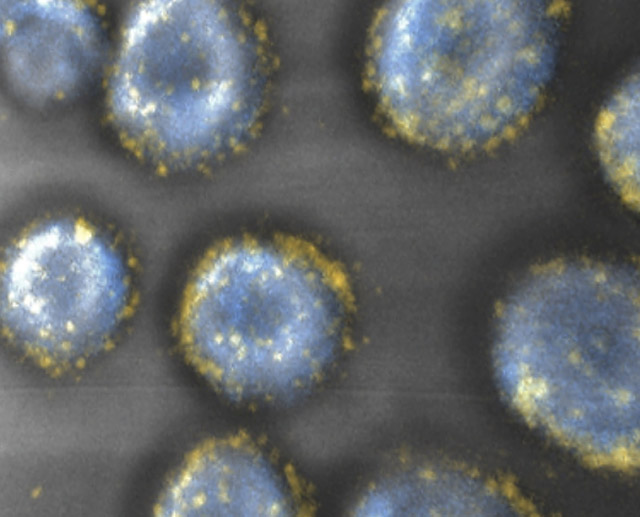 Figure 1: Nanoparticle-decorated T cells for cancer immunotherapy...